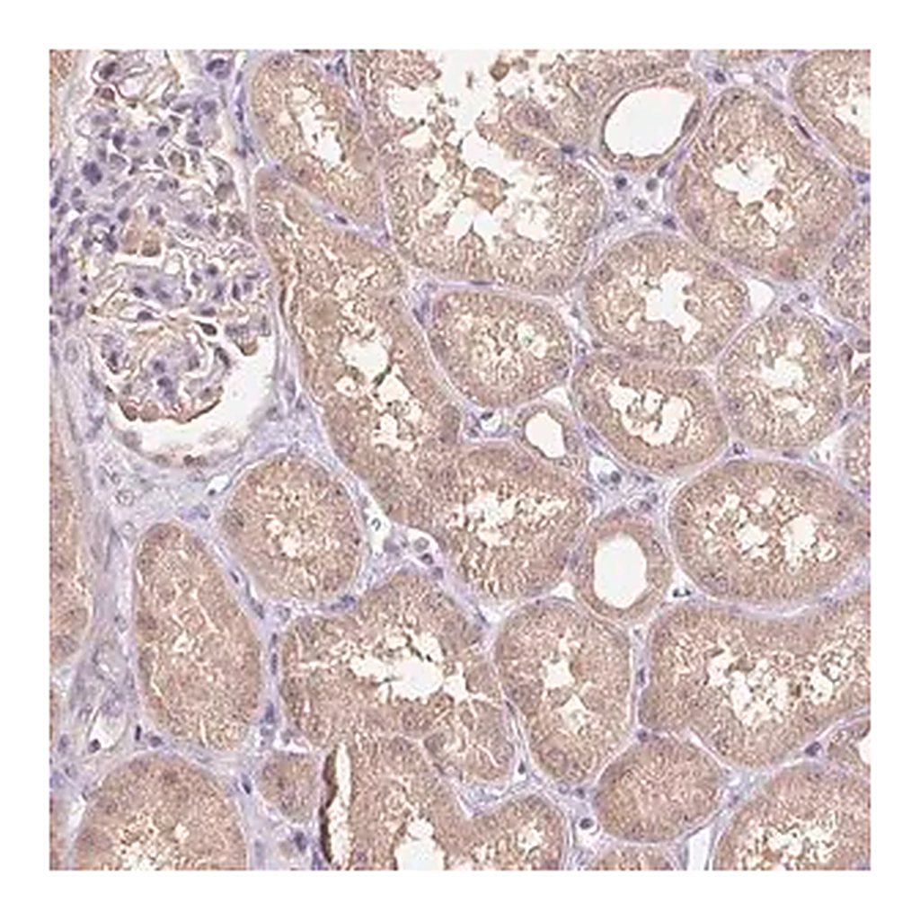 Merck Anti-C10orf128 antibody produced in rabbit