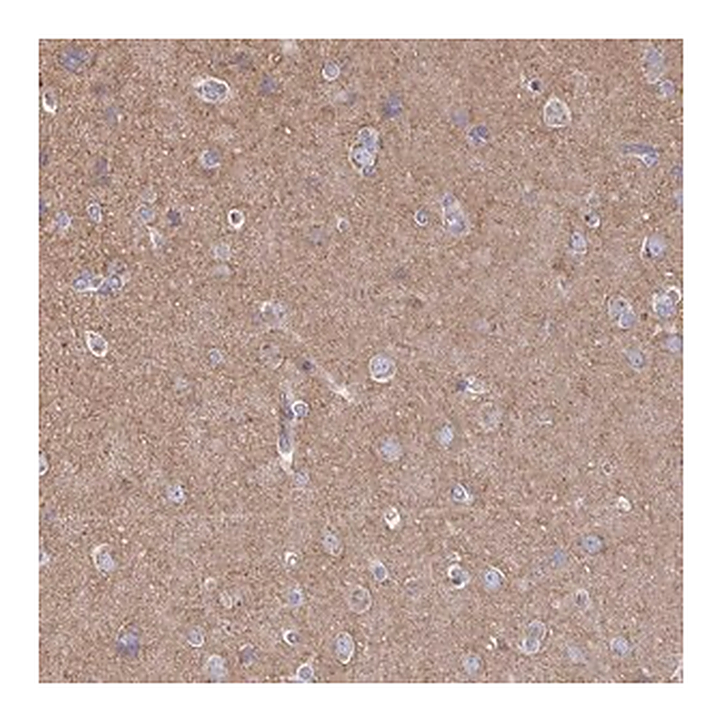 Merck Anti-CLTC antibody produced in rabbit