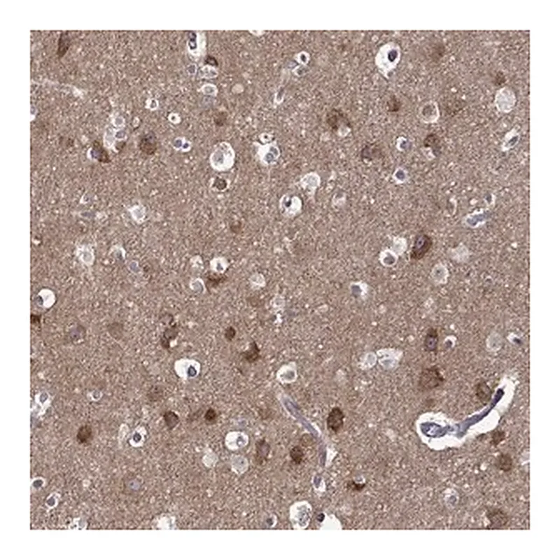 Merck Anti-TARBP2 antibody produced in rabbit
