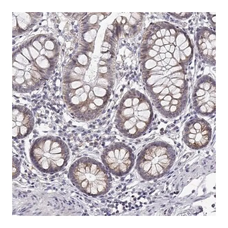 Merck Anti-TRIM60 antibody produced in rabbit