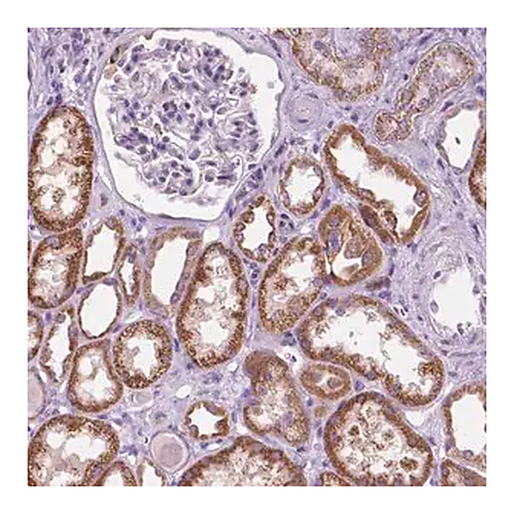 Merck Anti-TRPV5 antibody produced in rabbit