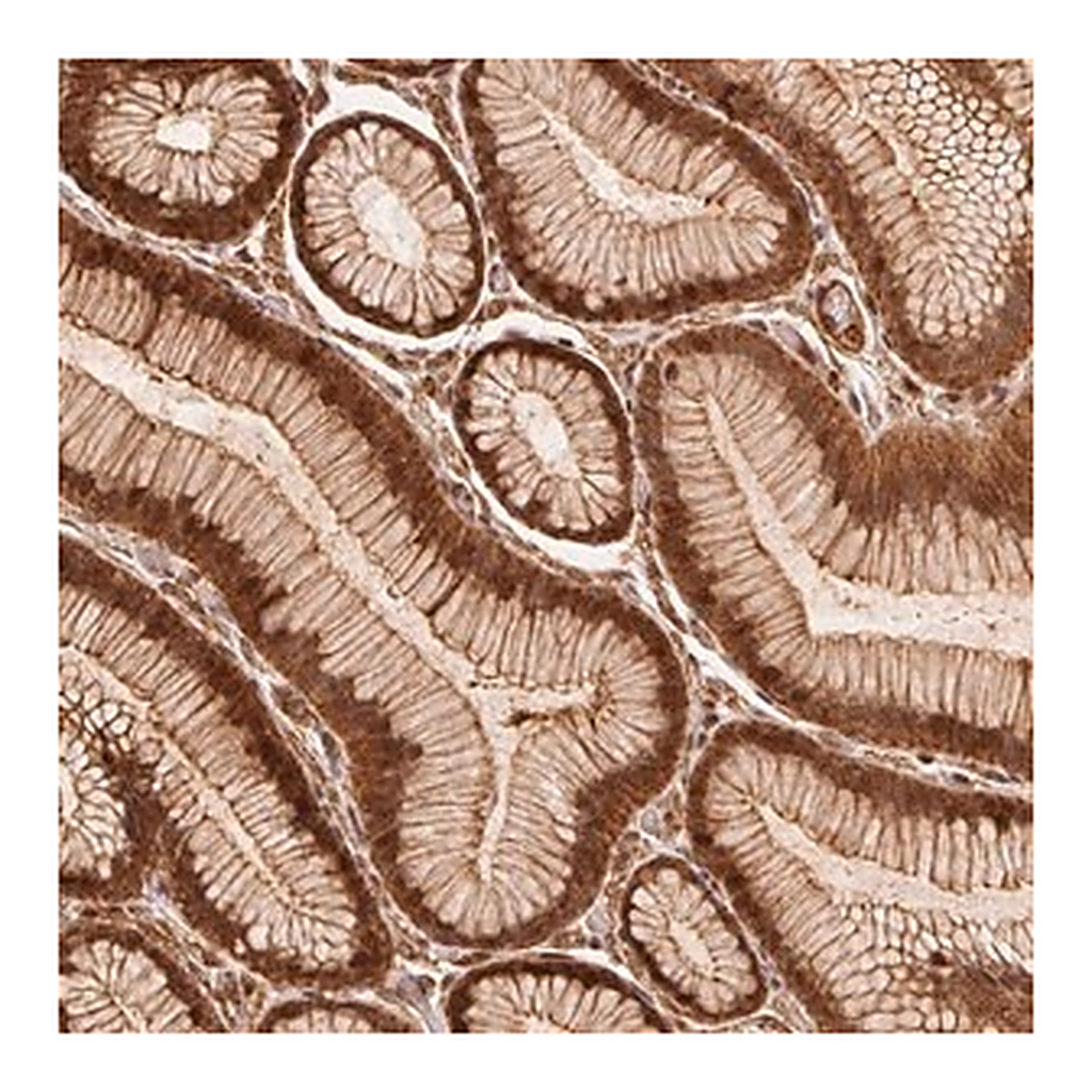Merck Anti-TNIP2 antibody produced in rabbit