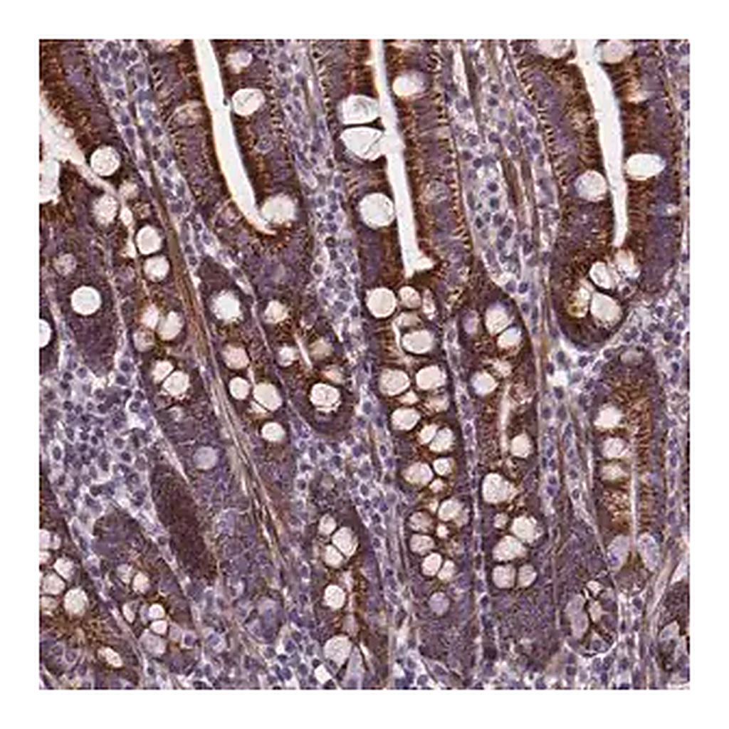Merck Anti-AEBP1 antibody produced in rabbit