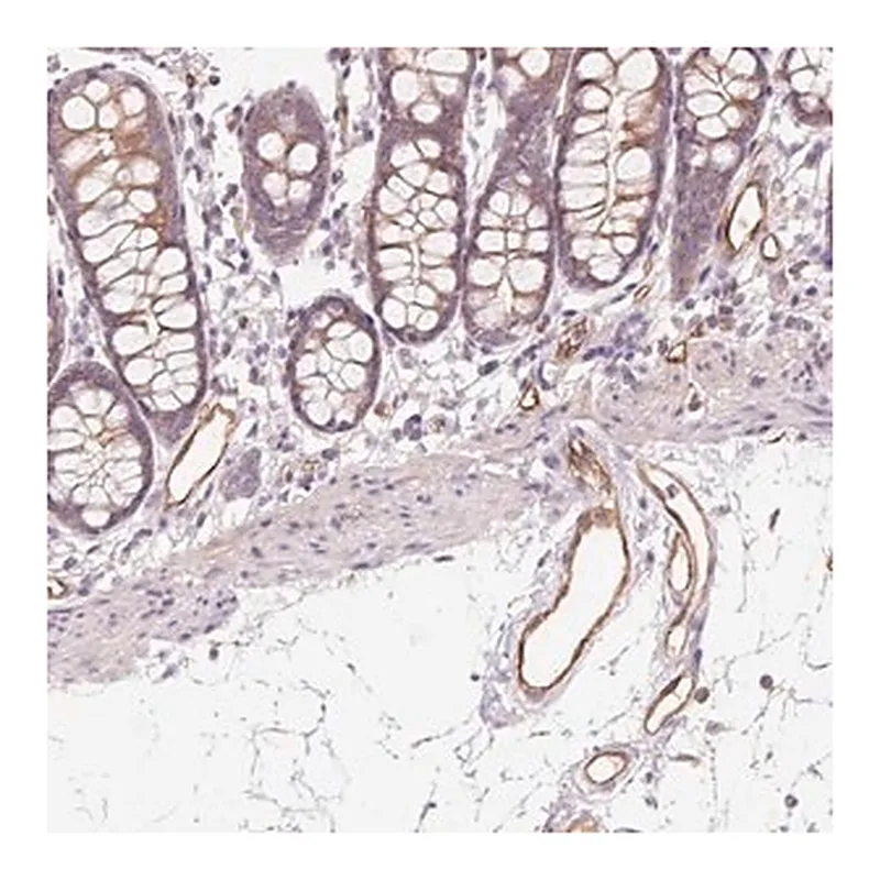 Merck Anti-ANKRD13B antibody produced in rabbit