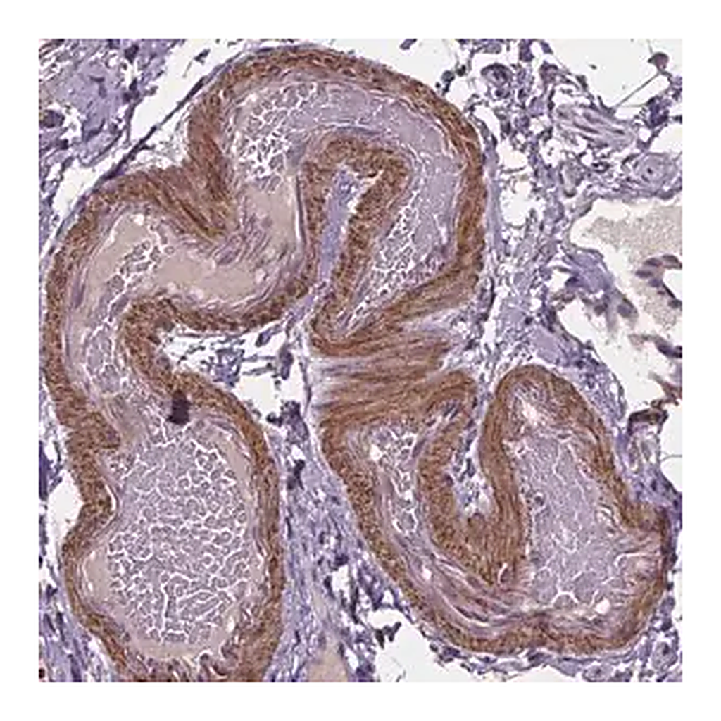 Merck Anti-CLN3 antibody produced in rabbit