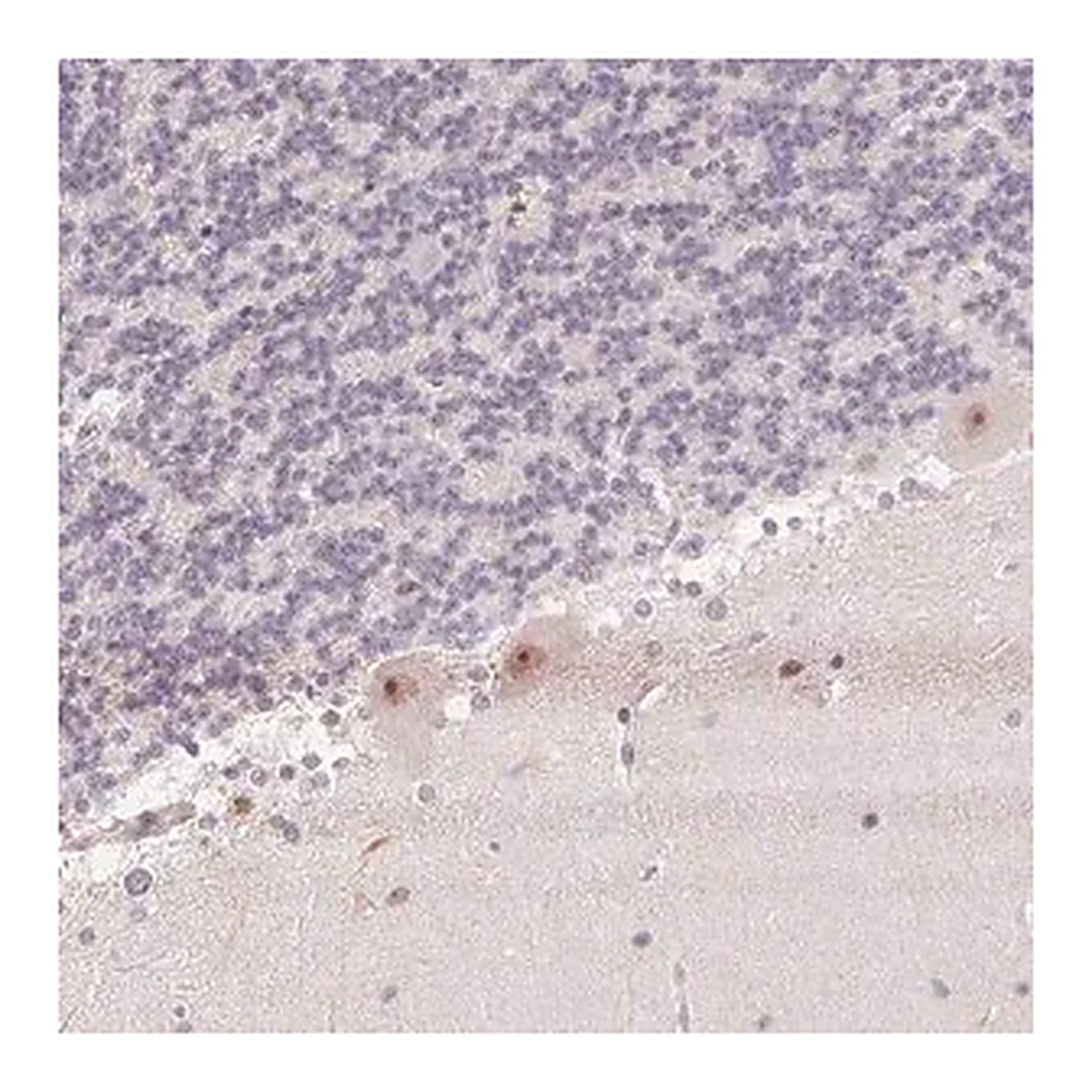 Merck Anti-KDM4D antibody produced in rabbit