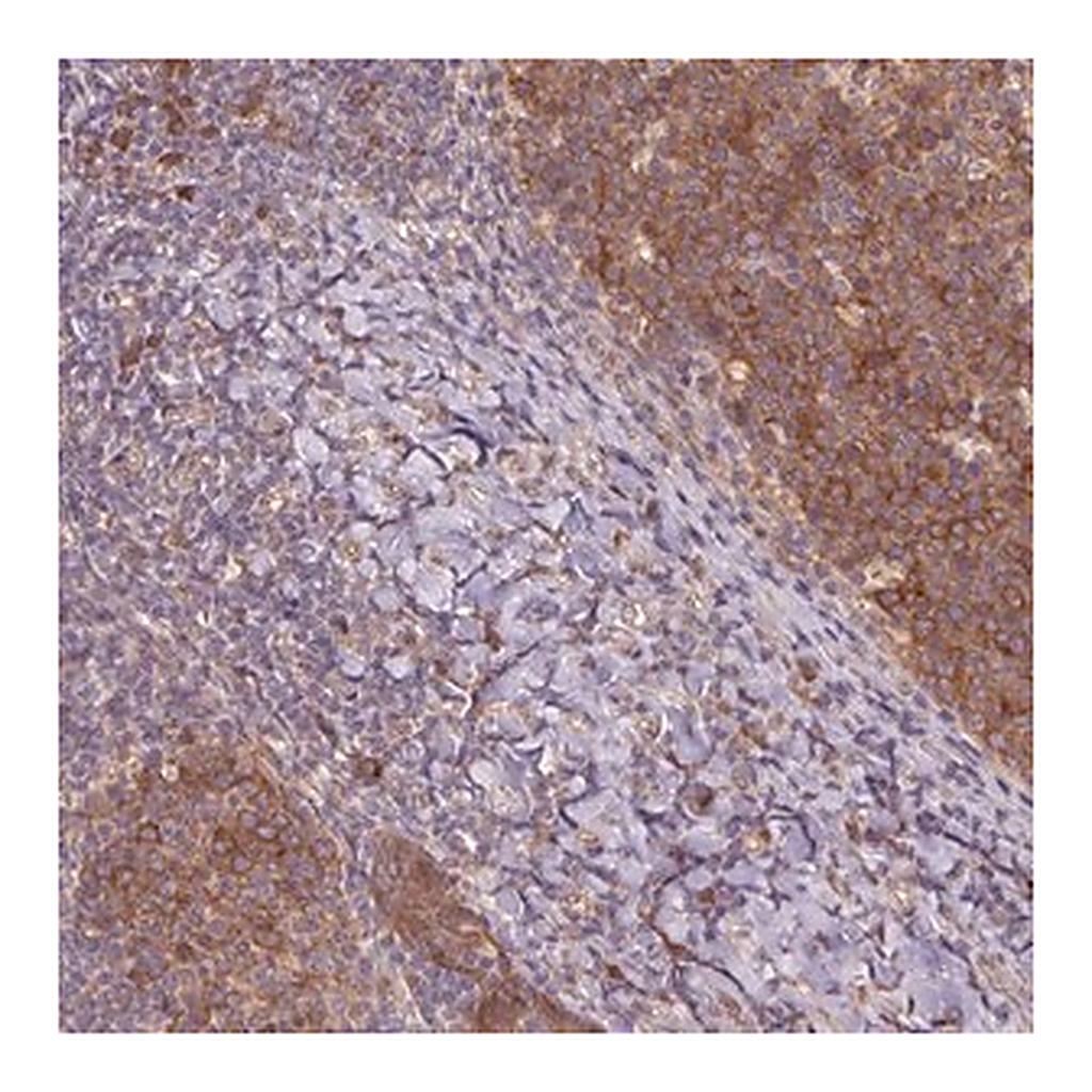 Merck Anti-RRM1 antibody produced in rabbit