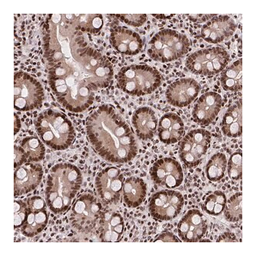 Merck Anti-AMER1 antibody produced in rabbit