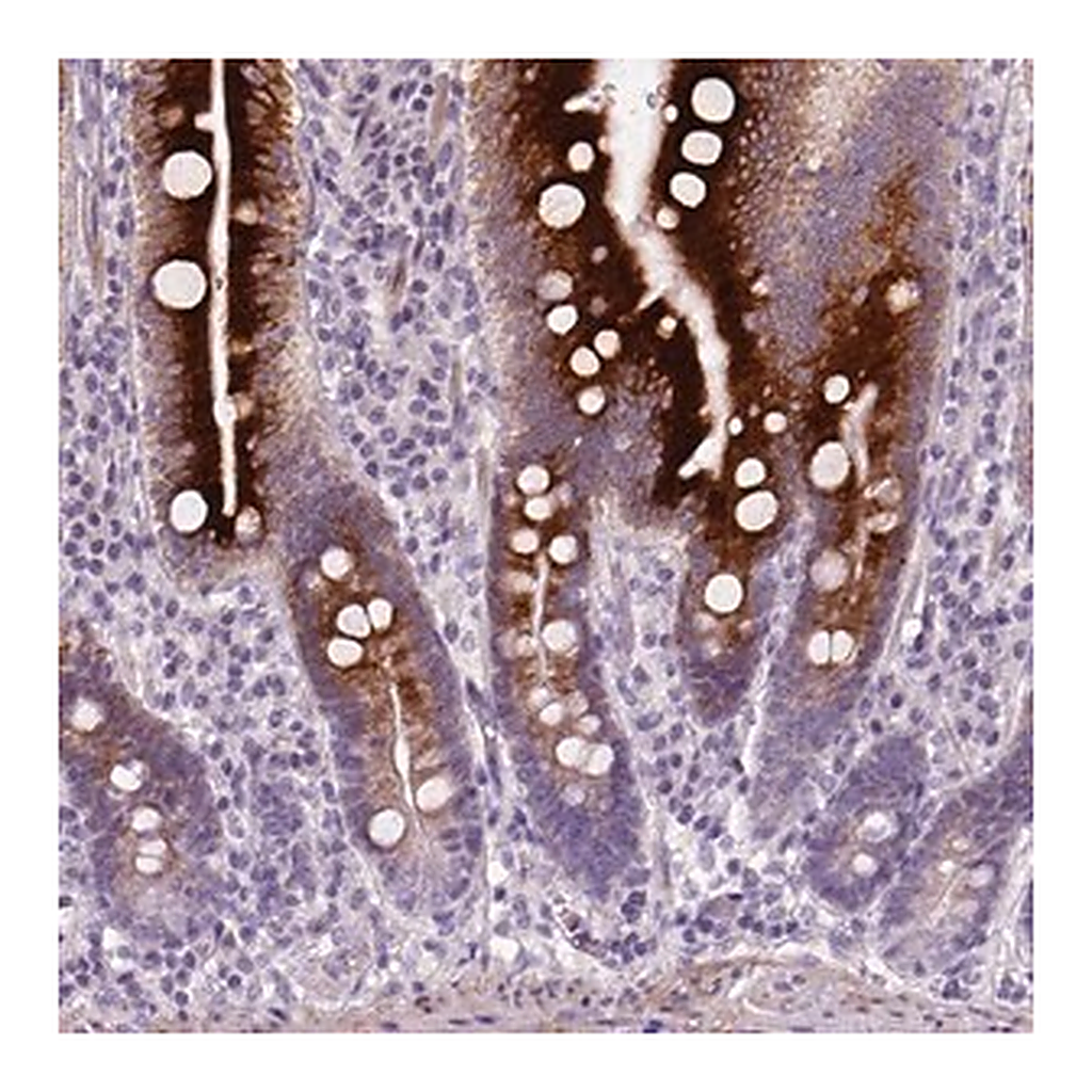Merck Anti-NUDT6 antibody produced in rabbit