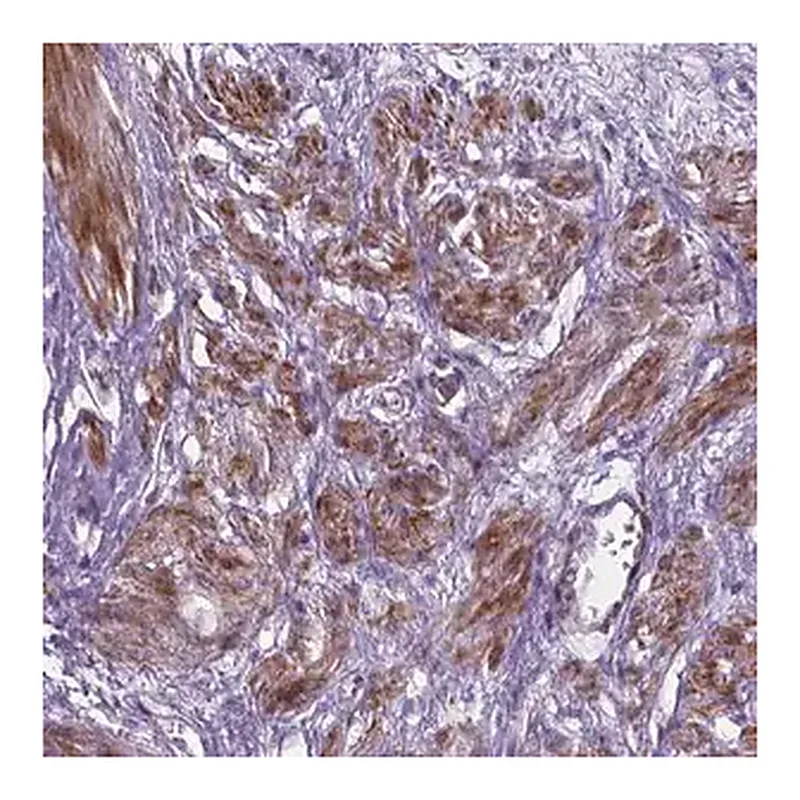 Merck Anti-PFKFB4 antibody produced in rabbit