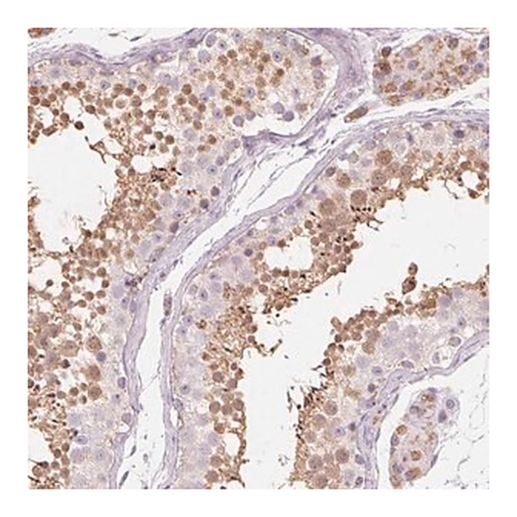 Merck Anti-NUP210L antibody produced in rabbit