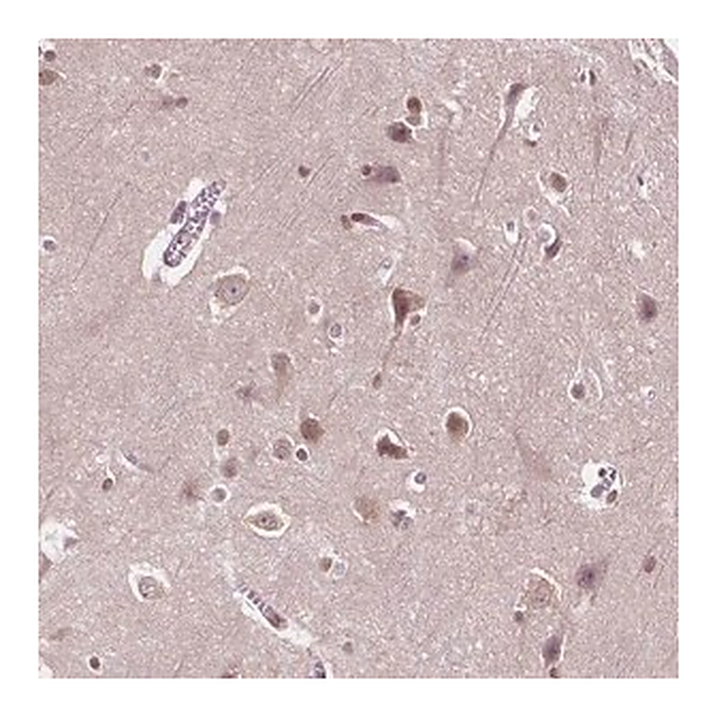 Merck Anti-ISLR2 antibody produced in rabbit
