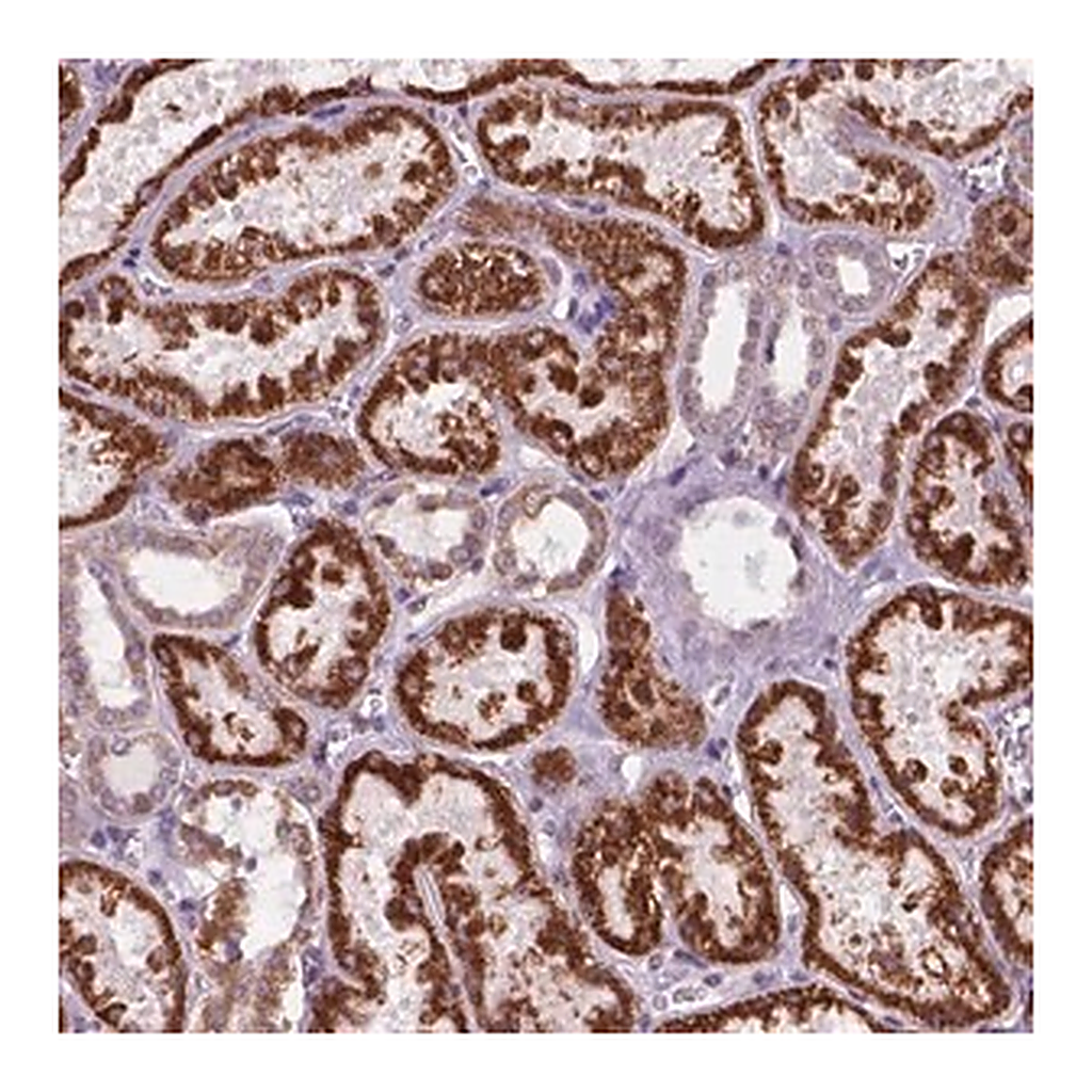 Merck Anti-C18orf21 antibody produced in rabbit