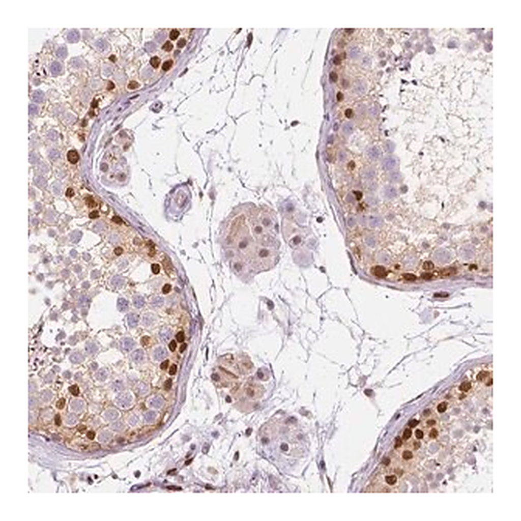 Merck Anti-ERF antibody produced in rabbit