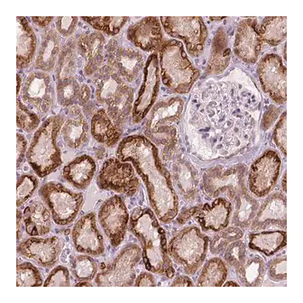 Merck Anti-CTC-534A2.2 antibody produced in rabbit
