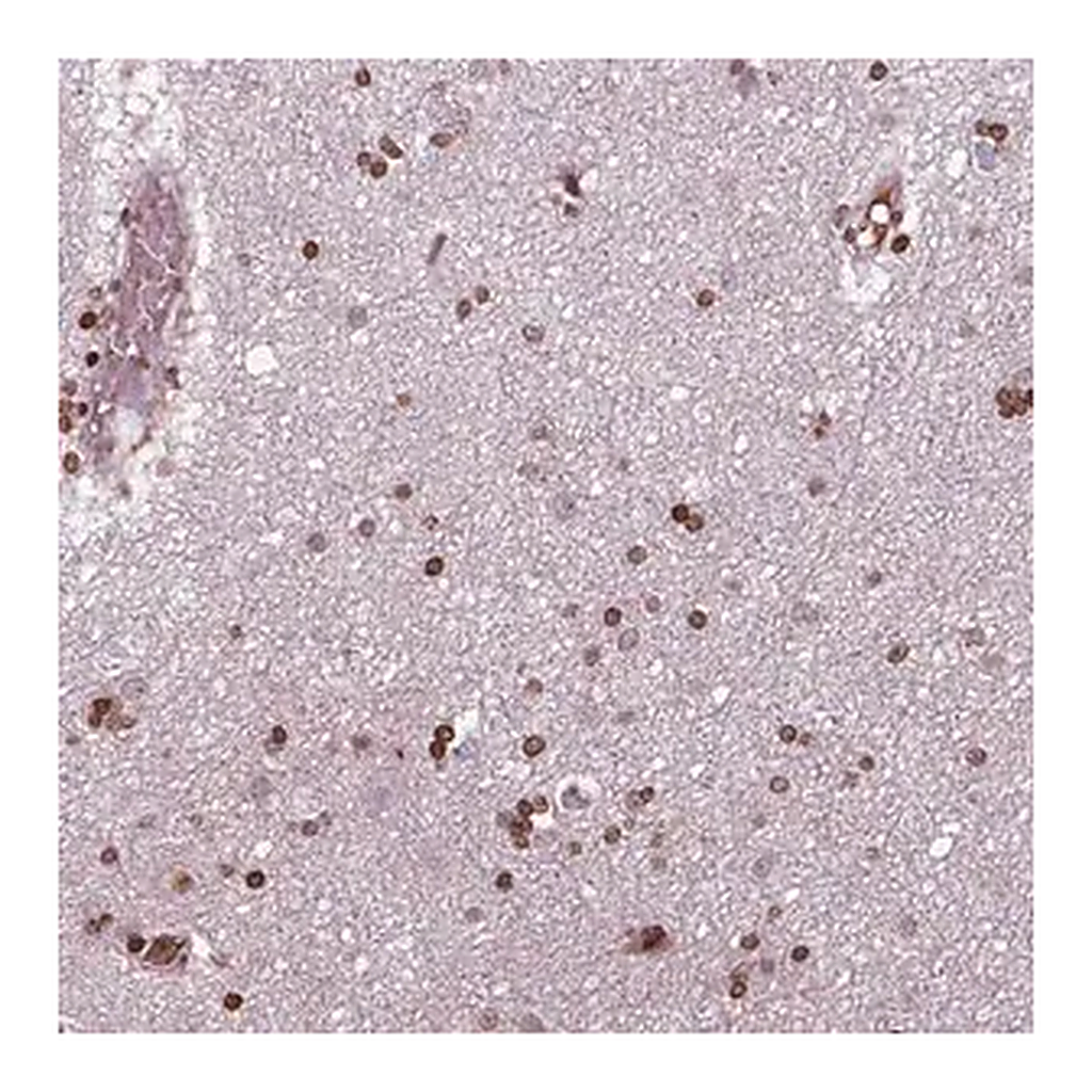 Merck Anti-PIP4K2A antibody produced in rabbit
