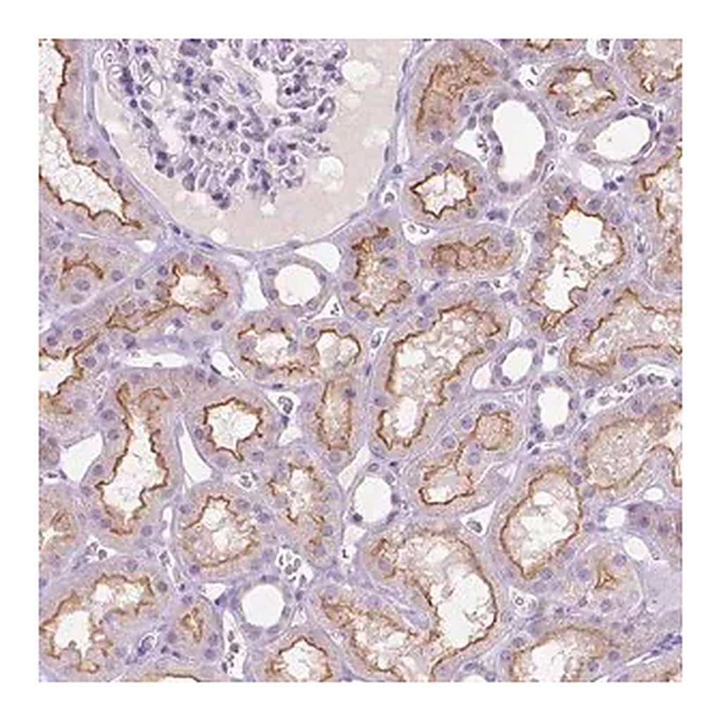 Merck Anti-MMP11 antibody produced in rabbit