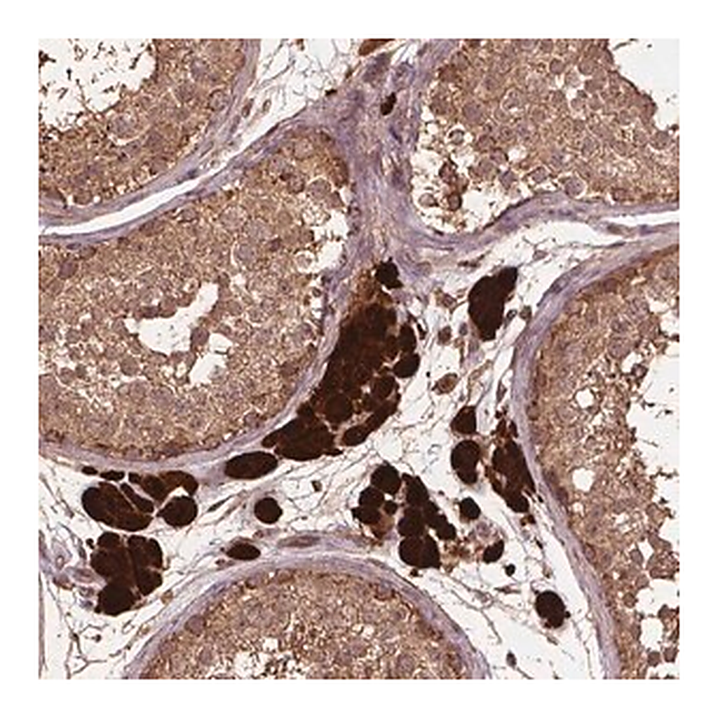 Merck Anti-BABAM1 antibody produced in rabbit
