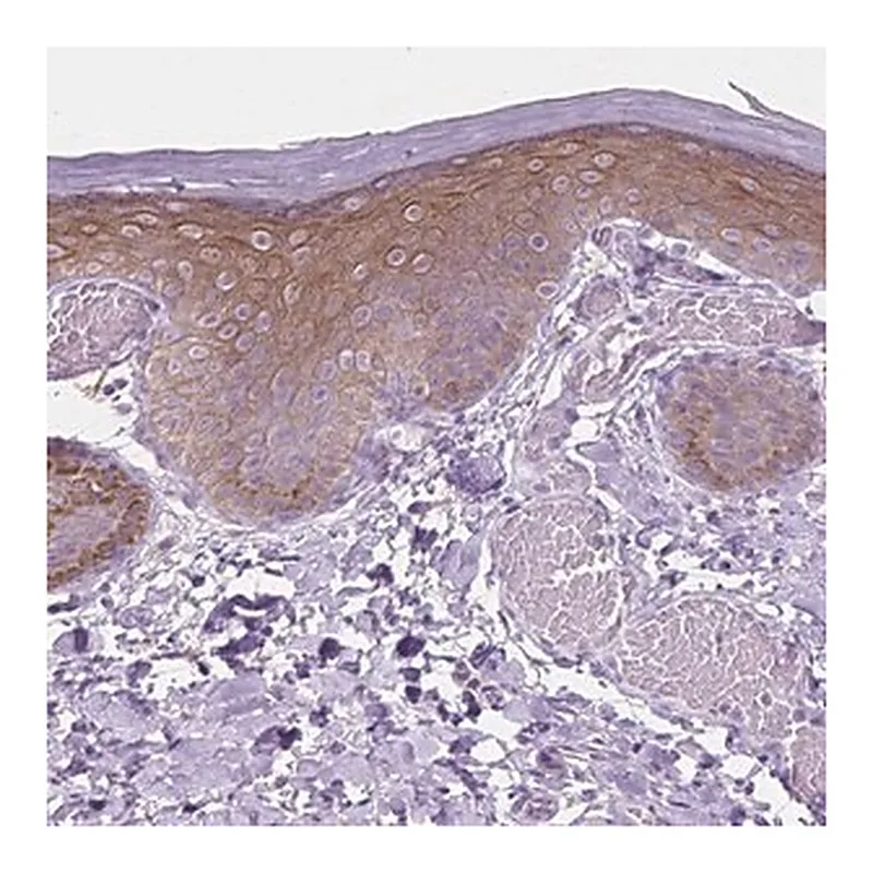 Merck Anti-EPPK1 antibody produced in rabbit