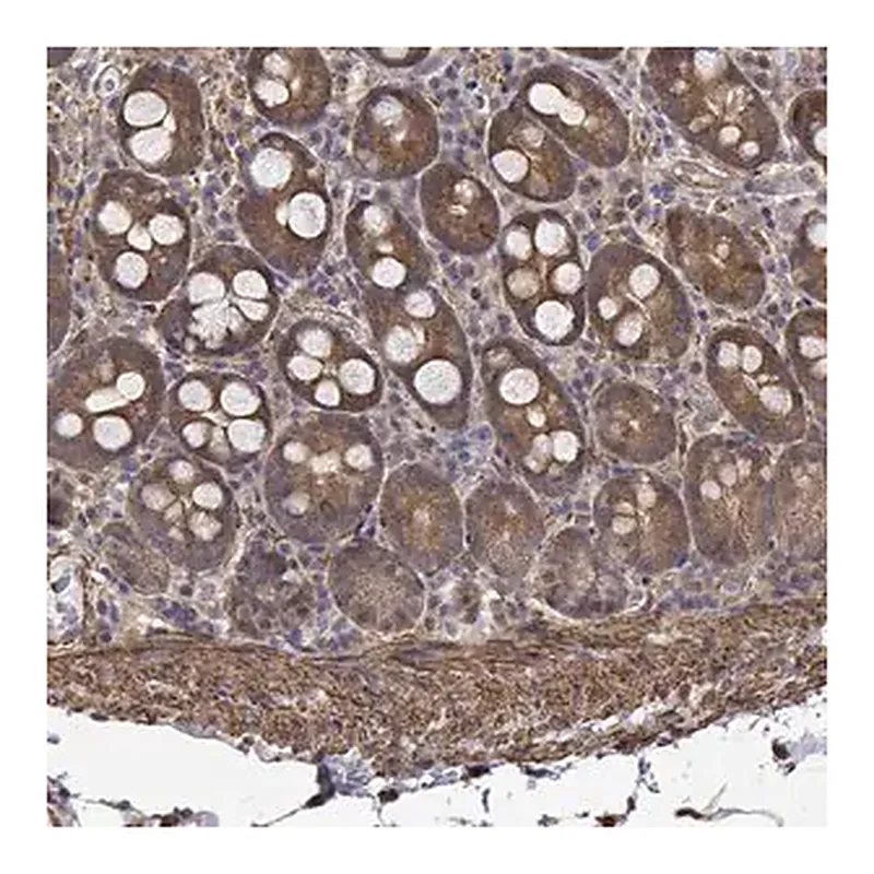 Merck Anti-PCID2 antibody produced in rabbit