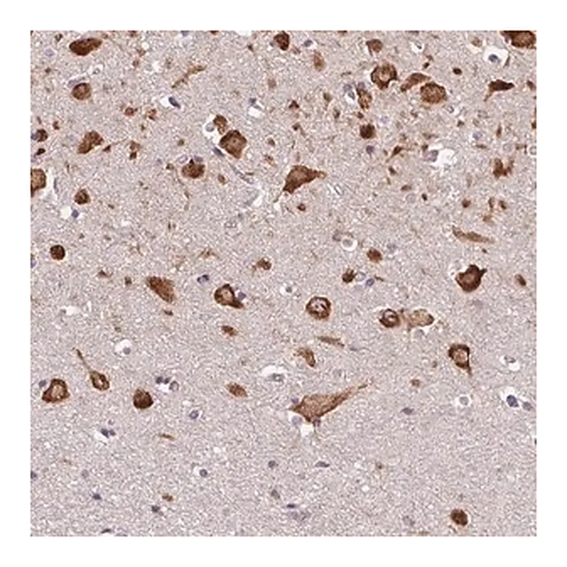 Merck Anti-DENND6A antibody produced in rabbit