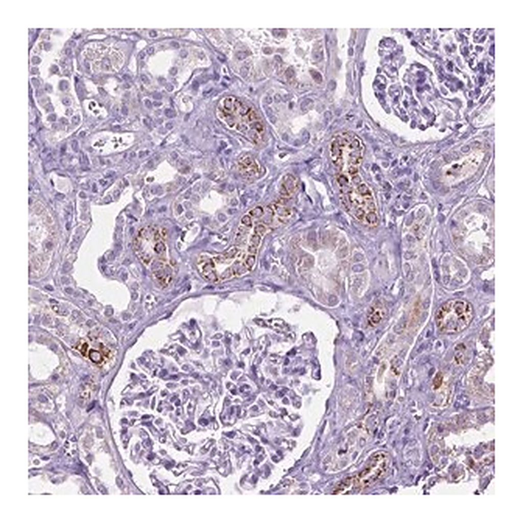 Merck Anti-TMEM132E antibody produced in rabbit
