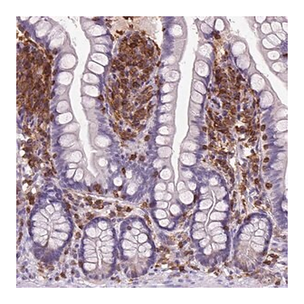 Merck Anti-INPP5D antibody produced in rabbit