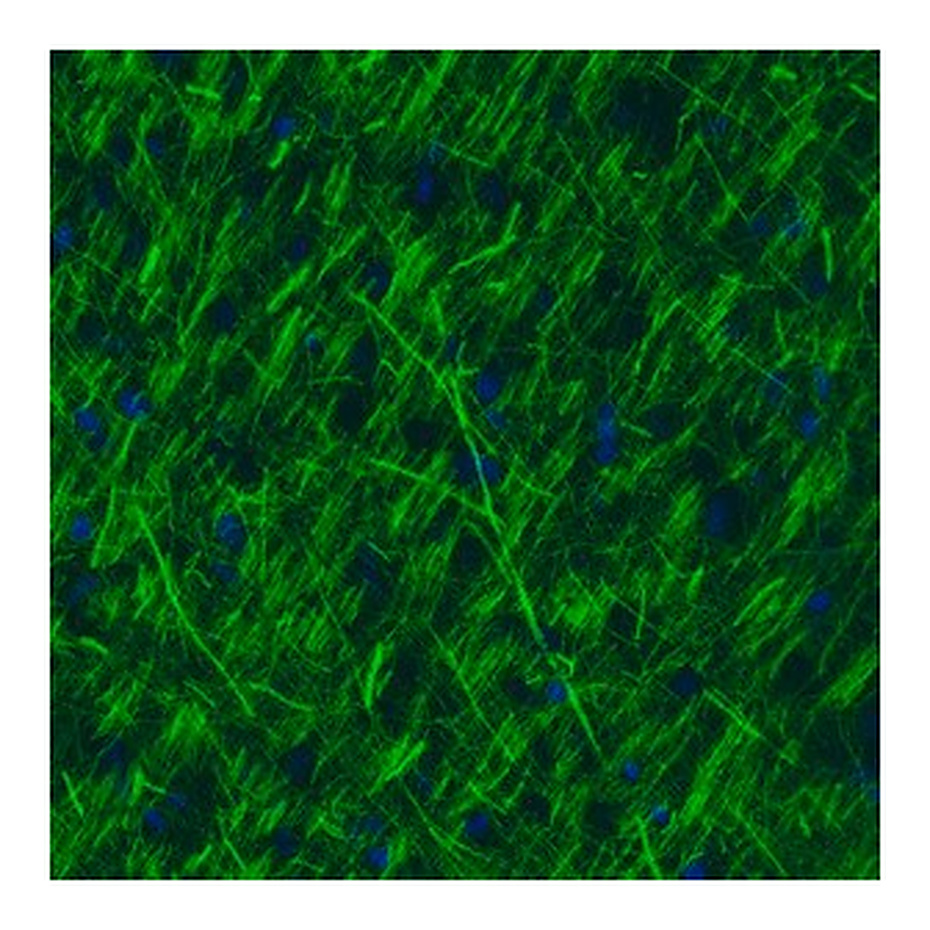 Merck Monoclonal Anti-NEFM antibody produced in mouse