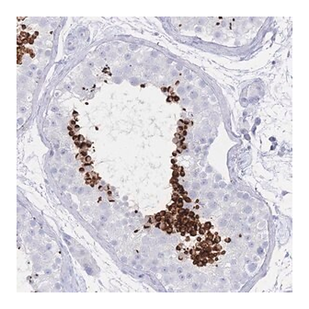 Merck Anti-LRRC37A antibody produced in rabbit