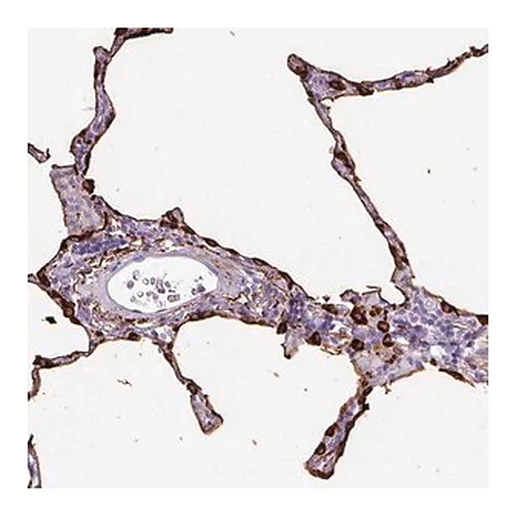 Merck Anti-SFTPA1 antibody produced in rabbit