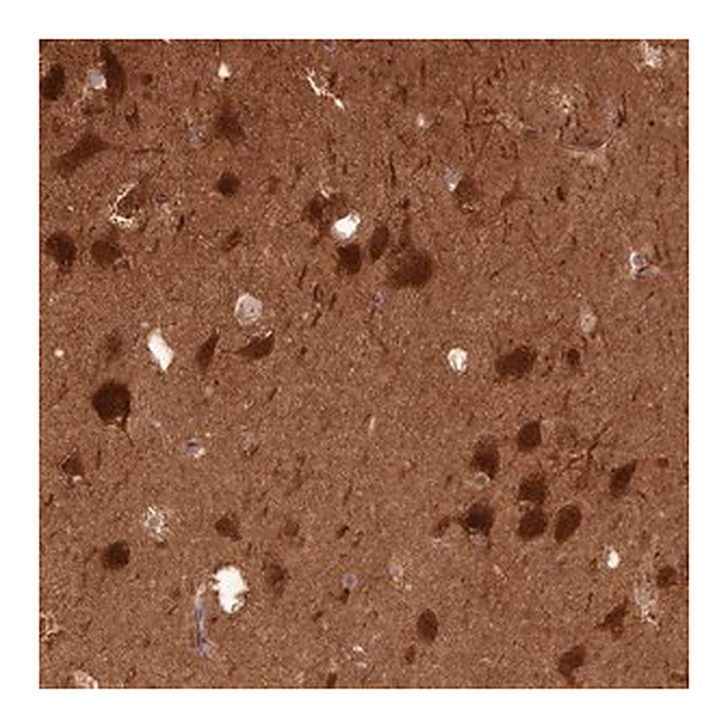 Merck Anti-PPP3R1 antibody produced in rabbit