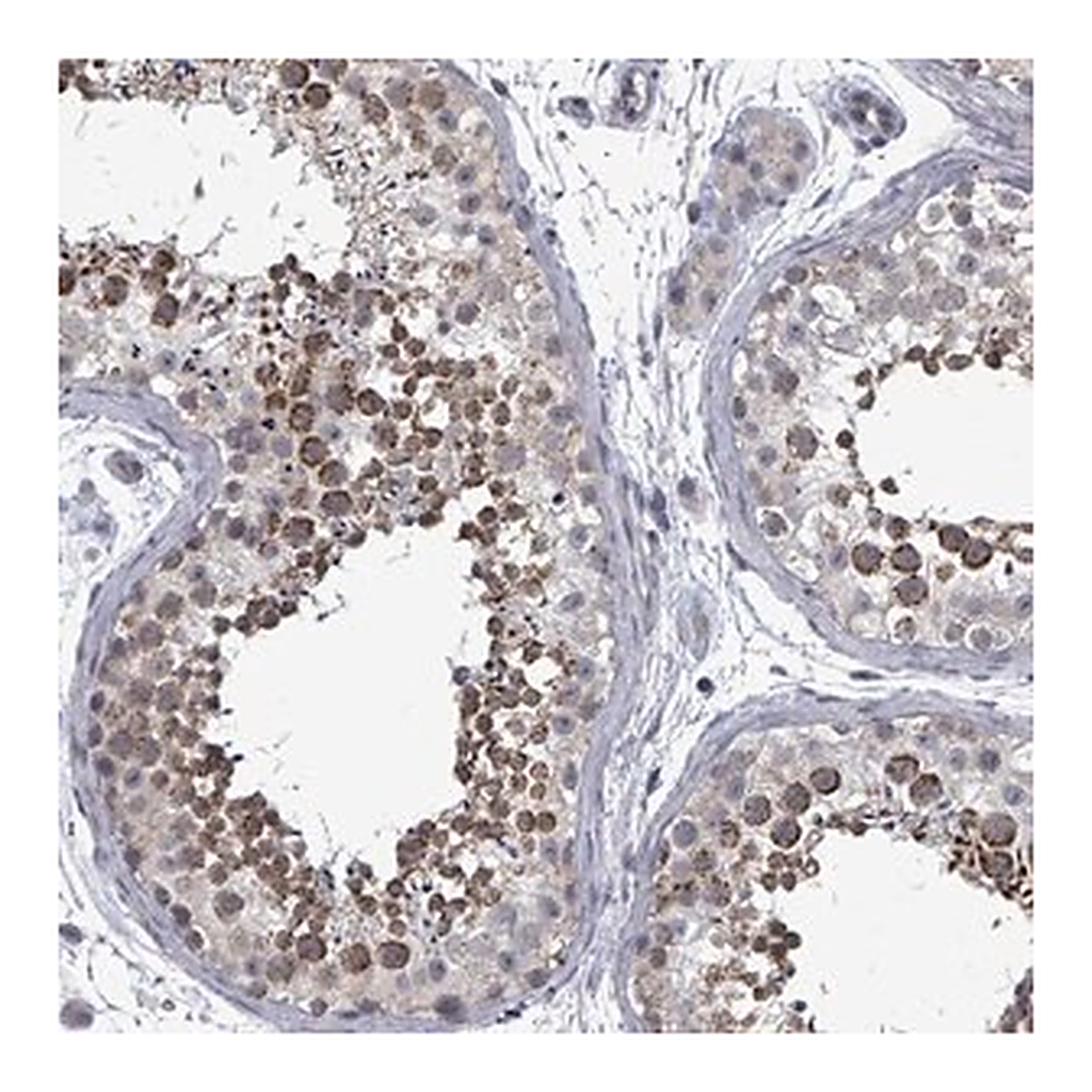 Merck Anti-PTPN20 antibody produced in rabbit