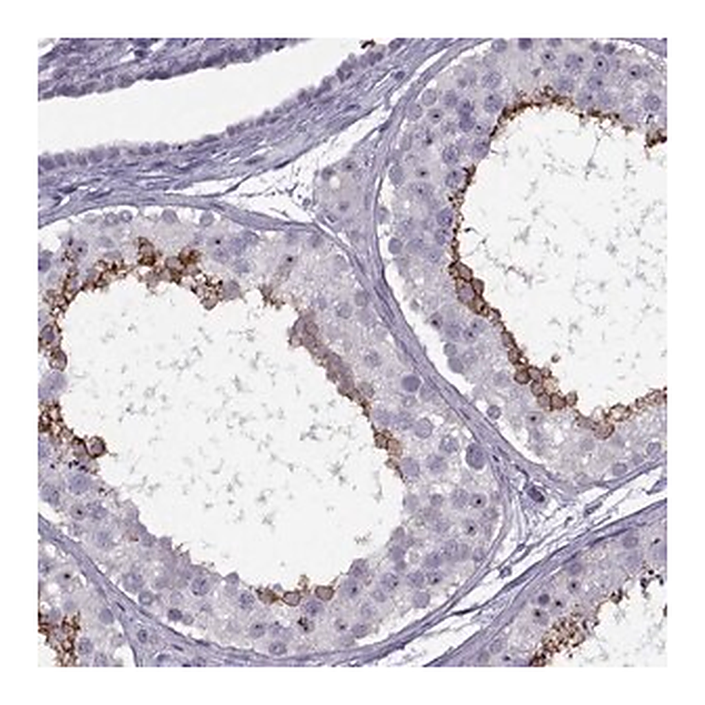 Merck Anti-TBC1D3C antibody produced in rabbit
