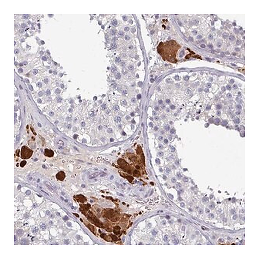 Merck Anti-PRAMEF7 antibody produced in rabbit