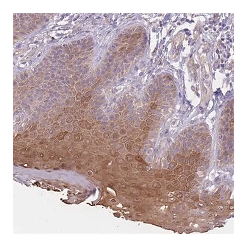 Merck Anti-SERPINB4 antibody produced in rabbit