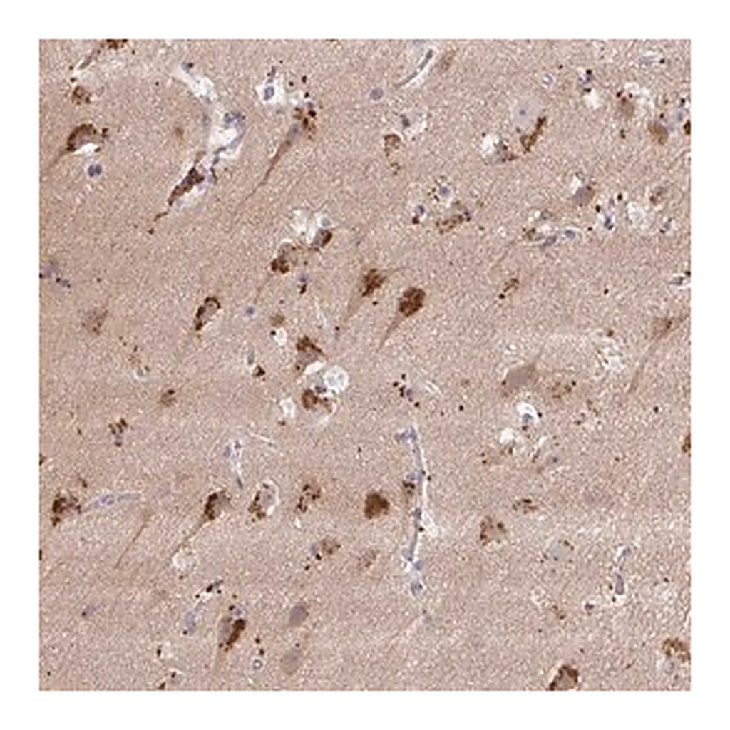 Merck Anti-MAP1LC3A antibody produced in rabbit