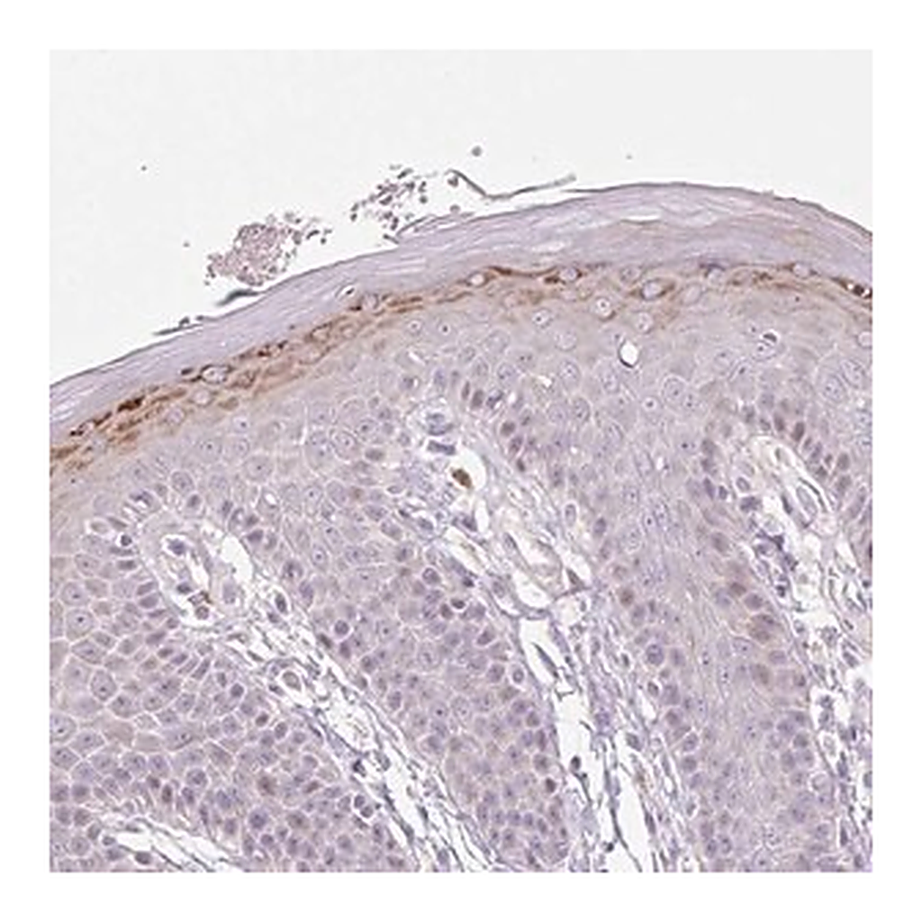Merck Anti-ZNF814 antibody produced in rabbit