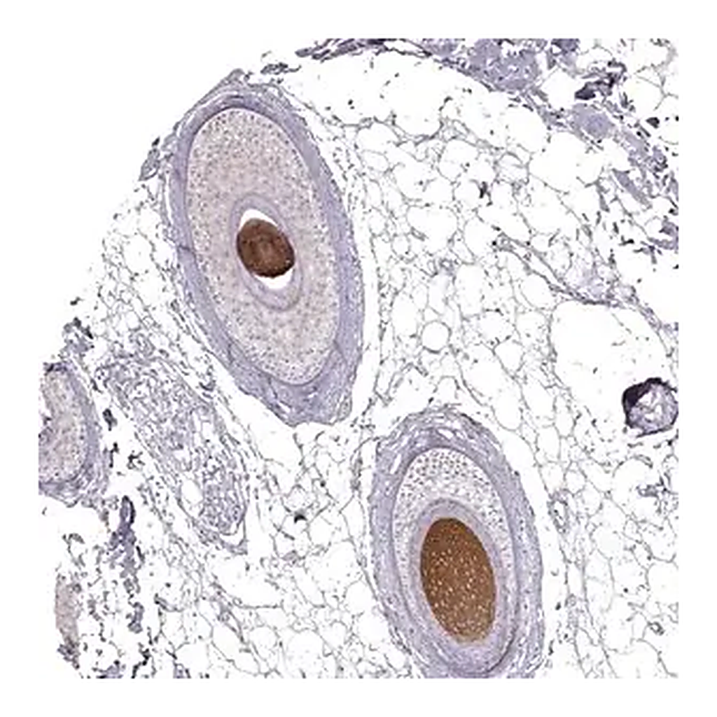 Merck Anti-KRT31 antibody produced in rabbit