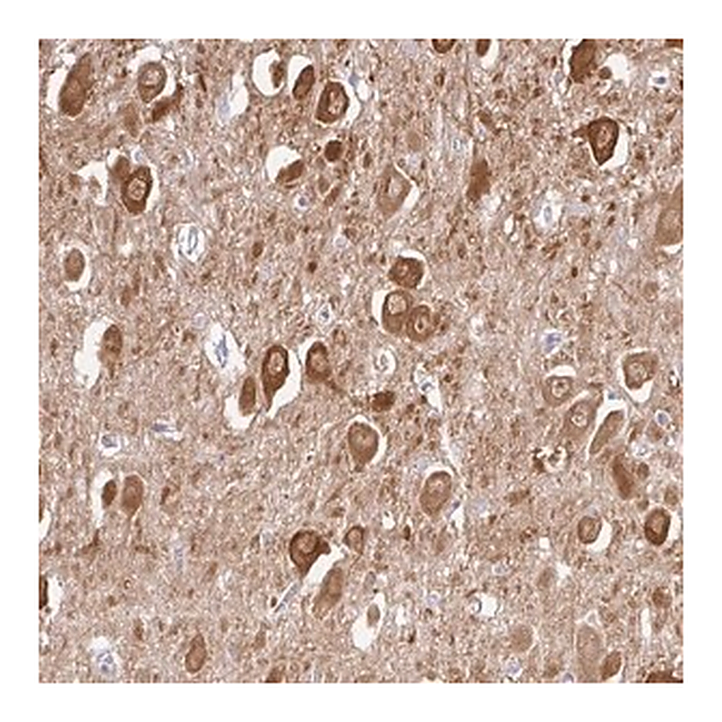 Merck Anti-CAMK2A antibody produced in rabbit