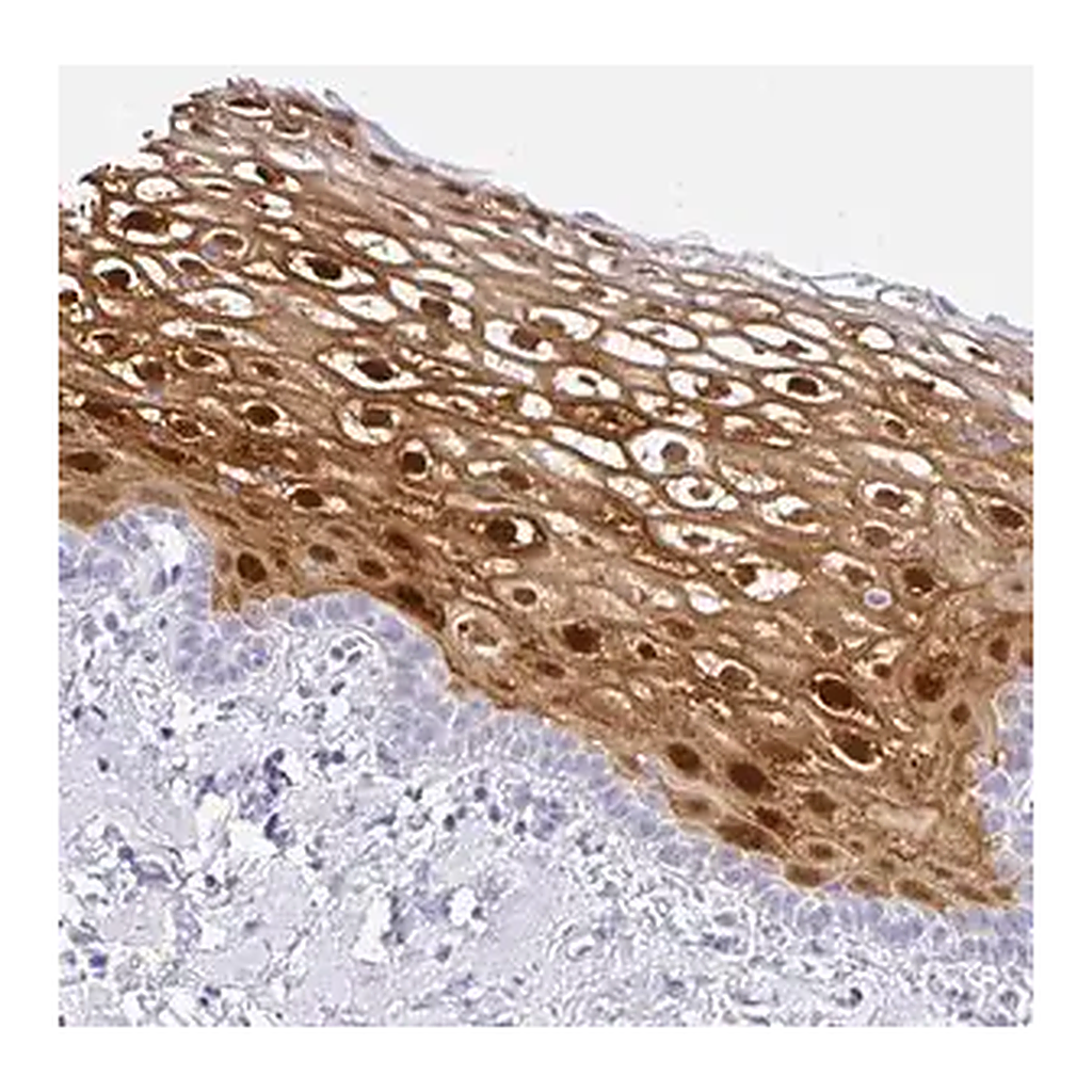 Merck Anti-SERPINB3 antibody produced in rabbit
