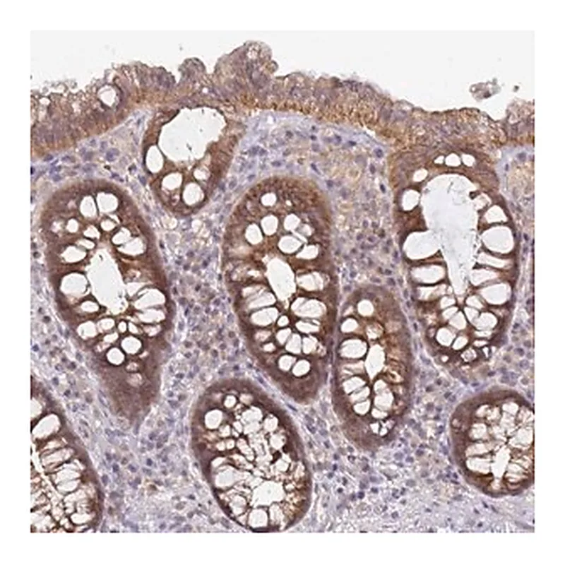 Merck Anti-GSTM1 antibody produced in rabbit