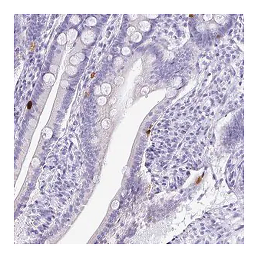 Merck Anti-PRAMEF19 antibody produced in rabbit