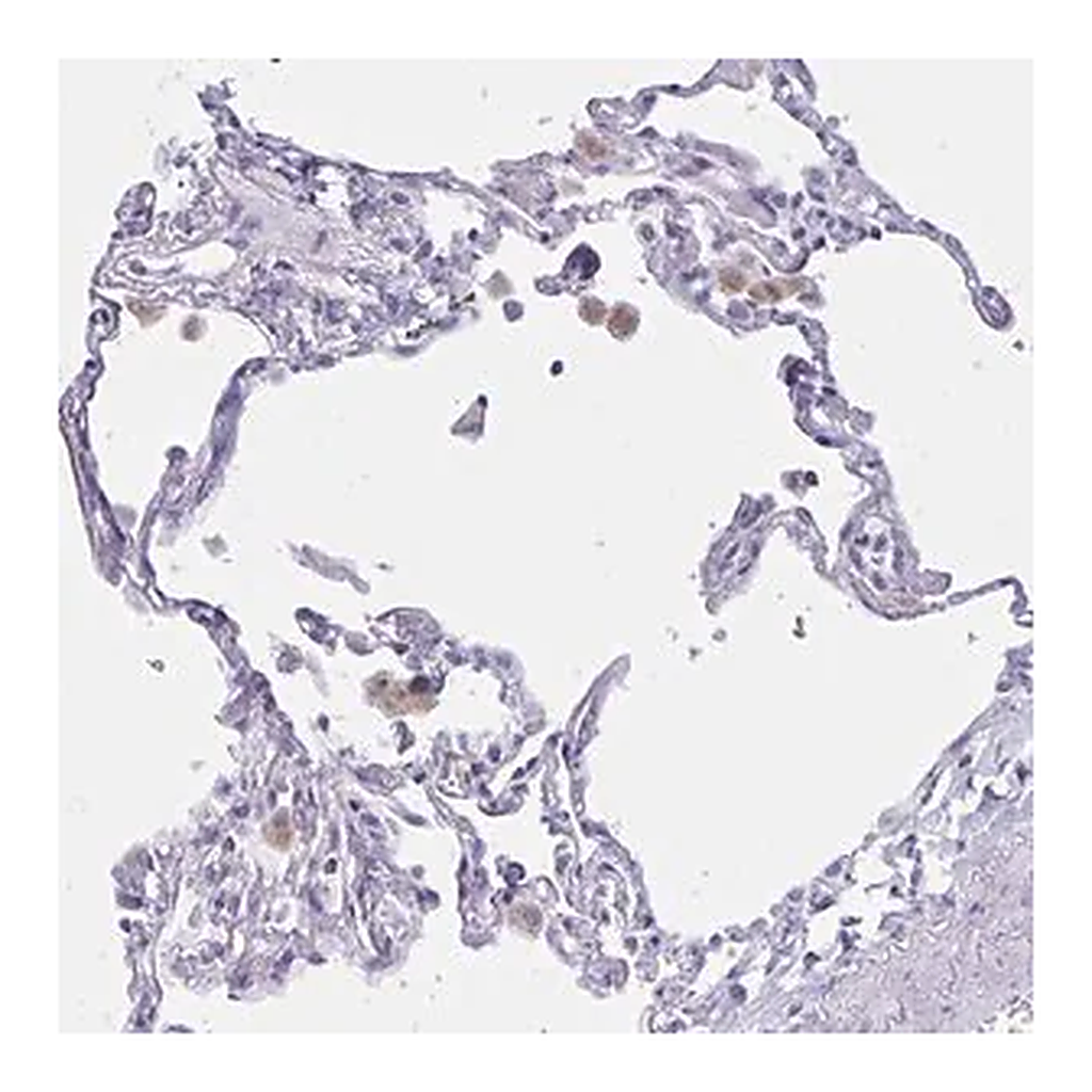 Merck Anti-XCL1 antibody produced in rabbit