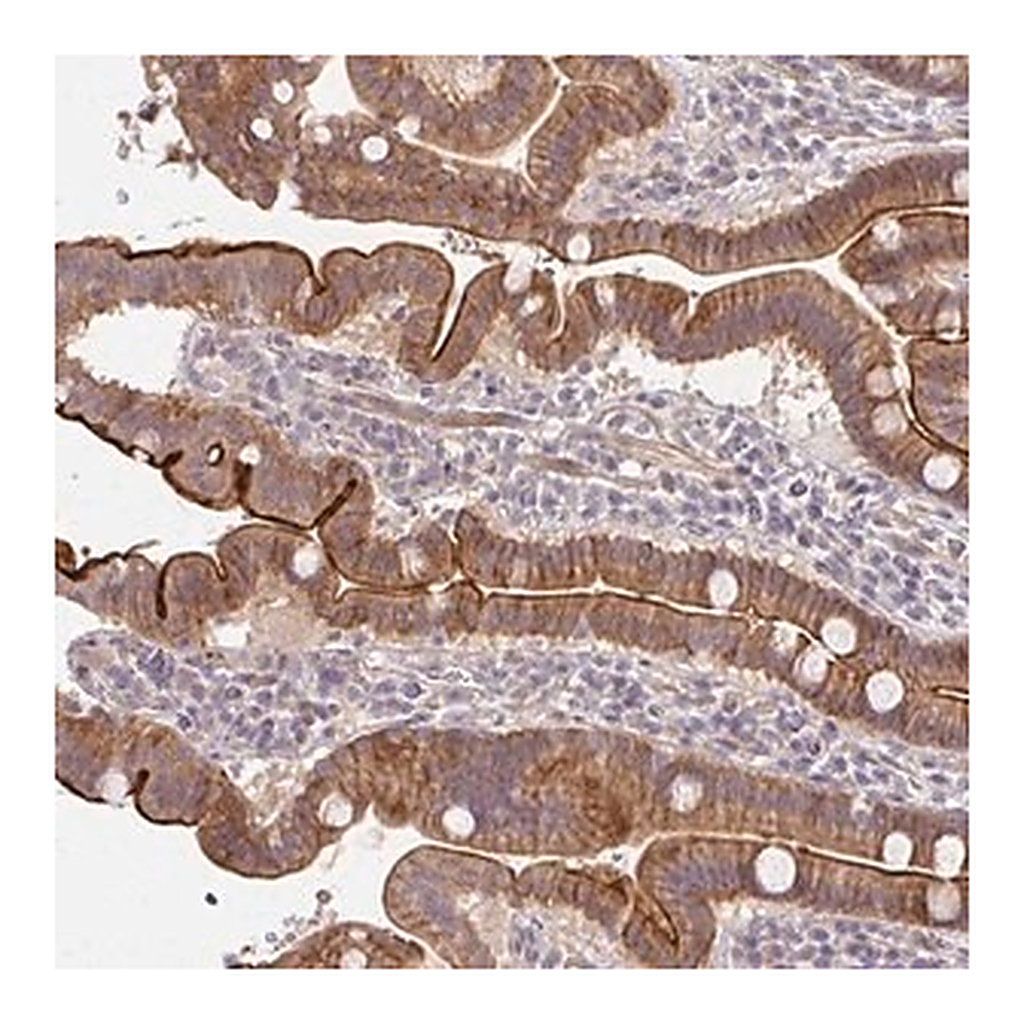 Merck Anti-CXorf40B antibody produced in rabbit