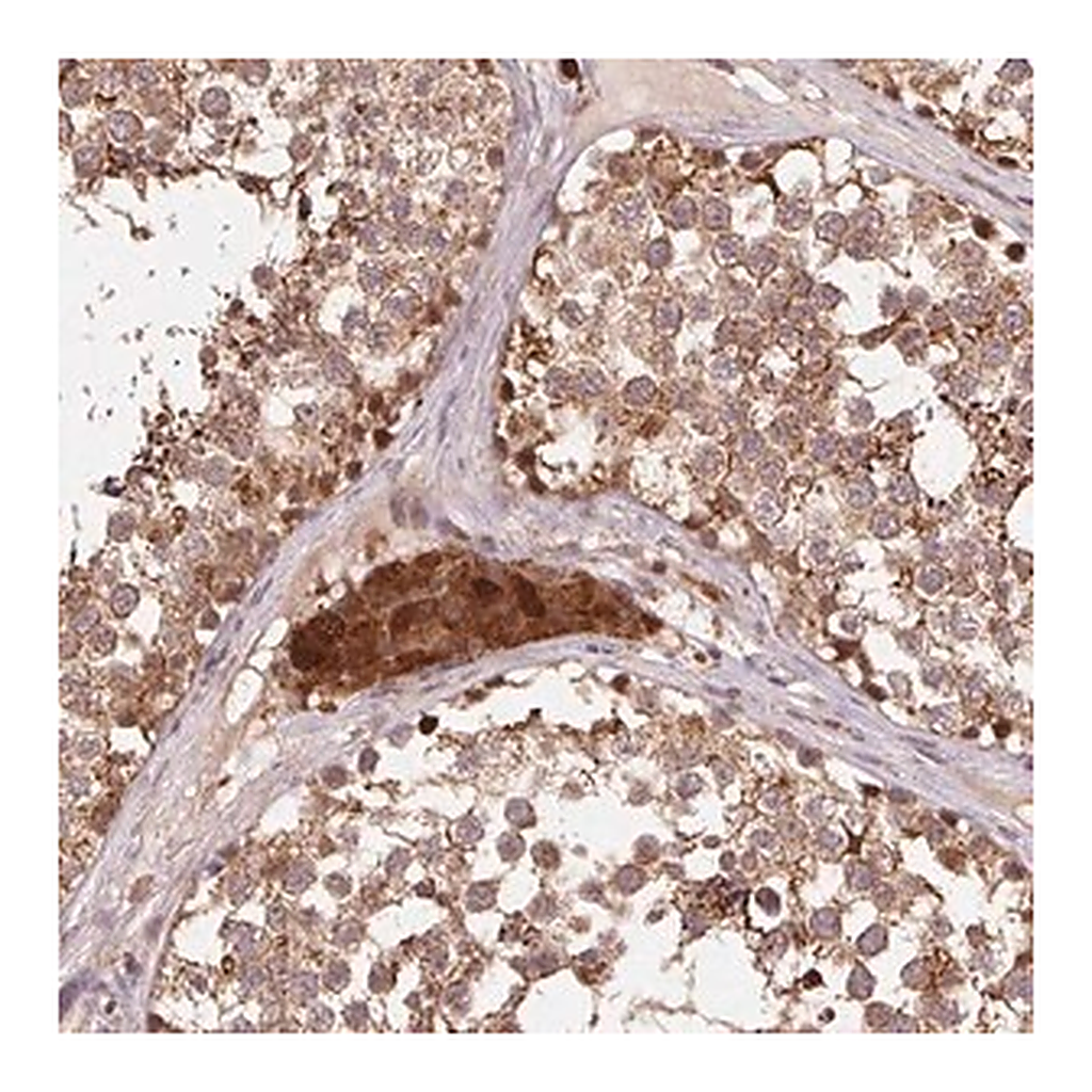 Merck Anti-PDHA1 antibody produced in rabbit