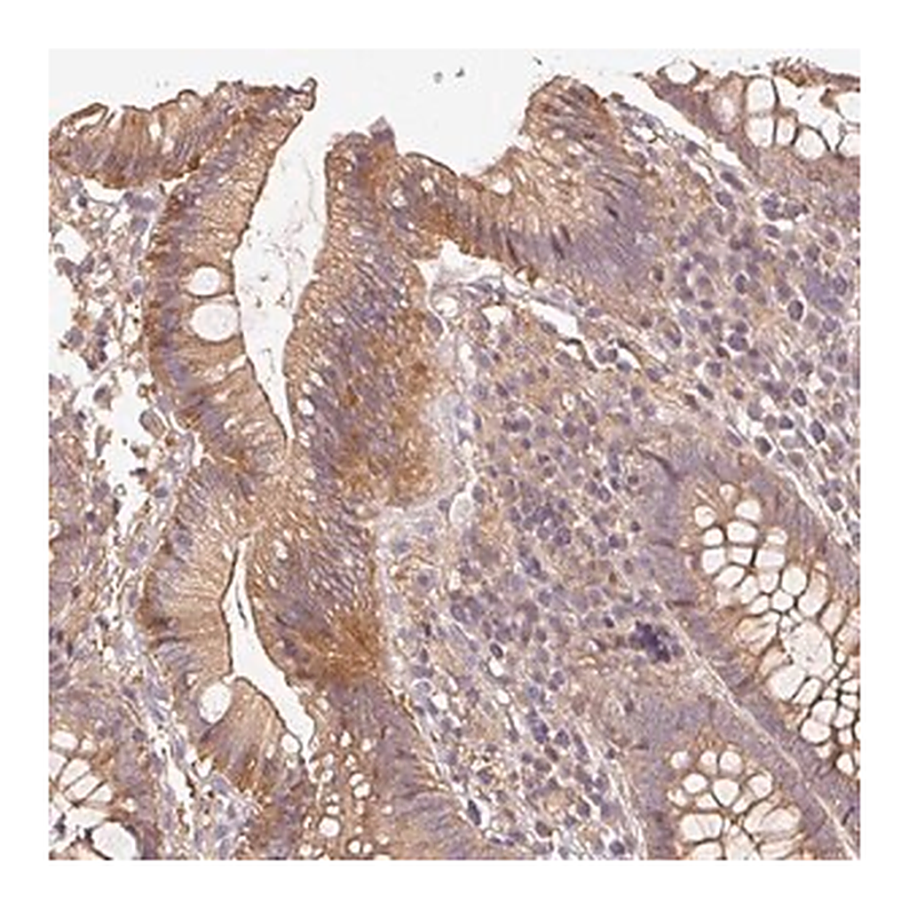 Merck Anti-RALA antibody produced in rabbit