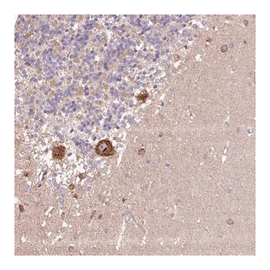 Merck Anti-PPME1 antibody produced in rabbit