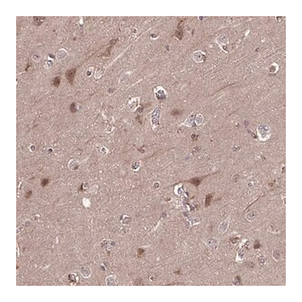 Merck Anti-TIGAR antibody produced in rabbit