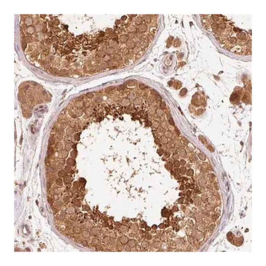 Merck Anti-RRAS2 antibody produced in rabbit