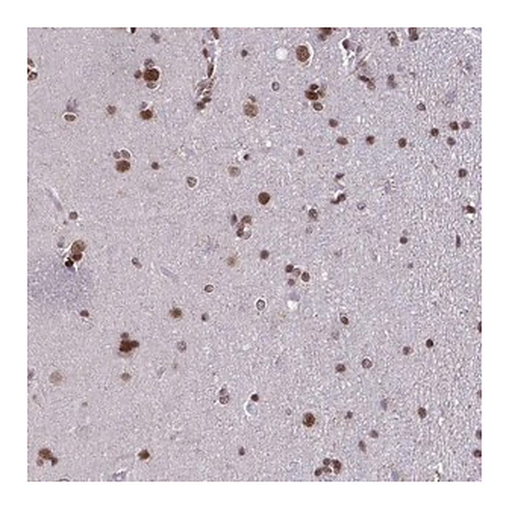 Merck Anti-TIMM21 antibody produced in rabbit